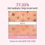 neaf neaf: Kaolin Purifying Wash Off Face Mask | Deep Cleansing | Exfoliation | Face Cleanser | Smooth & Clear Skin | 110gm