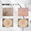 VT Cosmetics: Reedle Shot 300 Stick 2ml (10ea)