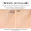 Neutrogena: Hydro Boost Hyaluronic Acid Nourishing Cream 50g
