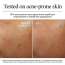 Neutrogena: Hydro Boost Hyaluronic Acid Nourishing Cream 50gm