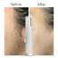 Protouch: DERMA PLANNING DEVICE For Hair Removal