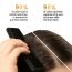The Skin Story: Anti Dandruff Shampoo 250ML