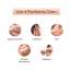 Protouch: DERMA PLANNING DEVICE For Hair Removal
