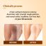 Fixderma: Foobetik Foot Scrub Spray with Lactic Acid 30 sec Scrubber -  50ml