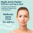 GUBB: Acne Pimple Patches 36 Dots/Sheet