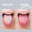 GUBB: Metal Tongue Cleaner In Loop Design for Effective Oral Hygiene
