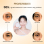 Mirabelle: Perfect Fit Hydrogel Eye Patch