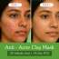 Bake Cosmetics: 2% Salicylic Acid + Zinc PCA + Niacinamide Clay Mask for Acne, Blackheads & Open Pores 100gm