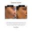 NERAH: Kudzu Restoring Serum   30ml