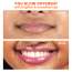Foxtale: Brightening Lip Balm With Peptides, Vitamin C & Hyaluronic Acid Bubblegum Pink Glaze 12ml