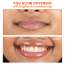 Foxtale: Brightening Lip Balm With Peptides, Vitamin C & Hyaluronic Acid - Clear Glaze 12ml