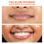 Foxtale: Brightening Lip Balm With Peptides, Vitamin C & Hyaluronic Acid - Light Mauve Glaze 12ml