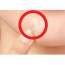 Oz Care: skin patch-104    10gm