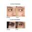 SKOG: Under Eye Repair Oil - 10ml