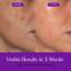 Bake Cosmetics: Night Peel RX Overnight Peel-Off Mask with Kojic Acid and Turmeric for Pigmentation, Tan, Dark Spot  100ml