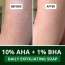 Bake Cosmetics: 10% AHA + 1% BHA Scrub Treatment Soap with Lactic Acid For Clogged Pores, Exfoliation, Strawberry Skin & Bright Underarms-Pack of 3(100g x 3)