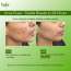 Bake Cosmetics: 2% Salicylic Acid Acne Spot Serum Gel -Overnight Acne Corrector for Pimples, Breakouts, Redness & Clogged Pores  30gm
