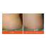 Skinvest: Bomb Bum Cream for Stretch Marks & Cellulite | Pregnancy-Safe Body Tightening Cream with Caffeine & Peptides | Built-In 5-Ball Massager for Firming, Smoothing & Elasticity | 100ml