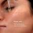 Skinvest: Slip Oil Facial Oil with 60% Phytosqualan, Rosehip & Watermelon Seed Oil | Barrier Repair Glow | 30ml