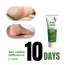 Detoxie: Foot Repair & Softening Cream 100gm