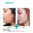 Dermatouch: Salicylic Acid 2% Niacinamide 6% Anti-Acne Oil Free Gel - 70gm