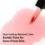 VT Cosmetics: Azelaic Acid Ampoule | Hydrating | Calm Redness | For Sensitive Skin | Healthy Skin | 30ml