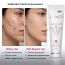 Ethiglo: Sebogel Salicylic Acid & Nicotinamide Gel 30gm Pack of 1