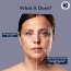 Dermistry: 2% Retinol Hyaluronic Anti Aging Night Face Cream Serum for Ageing Dark Circles & Wrinkles 30ml