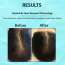 Dermistry: Anti Hair Fall Control Hair Serum with Follicusan Hairgenyl Caffeine for Strength & Growth 50ml