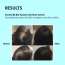 Dermistry: Anti Hair Fall Shampoo Caffeine Collagen for Root Strengthening Breakage Thinning Control 200ml