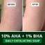 Bake Cosmetics: 10% AHA + 1% BHA Scrub Treatment Soap with Lactic Acid For Clogged Pores, Exfoliation, Strawberry Skin & Bright Underarms Pack of 4(100gm x 4)