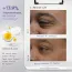 SkinInspired: iREVIVE Dual Chamber Under Eye Serum | Dark Circles & Puffiness Reduction | Eye Care | 24ml