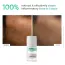 SkinInspired: AcNil3 Rapid Spot Corrector | Acne Spot Treatment | Pimple & Blemish Corrector | 12ml