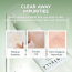 SKIN1004: Madagascar Centella Tea Trica Bha Foam  | Calming Care | Sensitive Skin | Face Cleanser | Deep Cleansing | Pore Care | 125ml