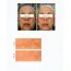 The Dewy Skin: Spot Correcting Face Serum | Dark Spot Corrector | Acne Marks | Pigmentation Care | Brightening | 30ml