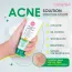 Cathy Doll: Acne Solution Serum Foam Cleanser | Anti-Acne Face Wash | Oil Control & Pore Care | 100ml