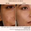 BiE: Calm Your Zits Anti-Acne Gel | For Spot Correction & Pimple Marks | Reduces Blemishes | Balances Oil | 20gm
