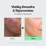 VT Cosmetics: Mild Reedle Shot 50 | Gentle Micro-Needling | Skin Renewal | Sensitive Skin | Daily Essence | 50ml