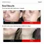 Frankly: Retinol 0.1% Cream | Anti-Aging | Wrinkle Care | Vitamin A | Vitamin E | Fine Lines | Beginner Retinol | Pore Refining | Korean Skincare | 30ml