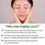 VT Cosmetics: Collagen Reedle Shot 100 Stick | Collagen Boost | Skin Firmness | Micro-Needling | Anti-Aging | 2ml × 10ea