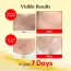 Eqqualberry: Vitamin Illuminating Cream | Brightening Face Cream | Glow Boost | Dark Spot Care | Moisturizing | 50ml