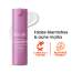 Foxtale: The Sweet Spot 7% Niacinamide Brightening Complex Serum | Fades Blemishes | Brightens Skin | Beginner-Friendly Formula  30ml