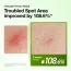 Anua: Azelaic Acid 10+ Hyaluron Redness Soothing Serum | For Blemish | Calms Acne-Prone Skin | 30ml