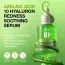 Anua: Azelaic Acid 10+ Hyaluron Redness Soothing Serum | For Blemish | Calms Acne-Prone Skin | 30ml