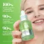 Anua: Azelaic Acid 10+ Hyaluron Redness Soothing Serum | For Blemish | Calms Acne-Prone Skin | 30ml