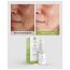 Priveda: Niacinamide Face Serum For Acne Marks And Acne Prone Skin For Men and Women - 30ml