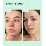 COSRX: BHA Blackhead Power Liquid Exfoliant Essence | Hydration | Glass Skin | Exfoliation | Pore Care | Smooth Skin | 100ml